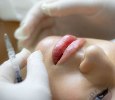 labios